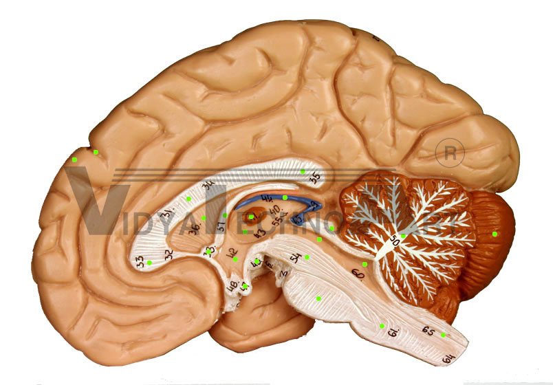 Brain II-Sagittal Section